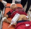 Day 328: Israeli Missiles Kill And Injure Dozens In Gaza