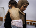 'Starvation, Destitution and Death' | In First, UN Says Over Half a Million Gazans Suffering From Famine; Netanyahu: 'Outright Lie'